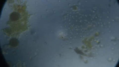 Water sample under microscope showing microorganisms and contaminants in de.. 스톡 동영상 337936364