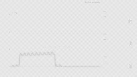 Waveform Capnography CPR to ROSC EtCO2 Rise Monitor Transparent Alpha Stock Footage 347260483
