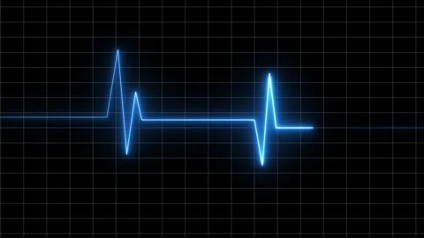 Waveforms and Signal Distortion Visualization Stock Footage 332824379