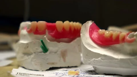Wax blanks of removable dentures on models Stock Footage 212142805