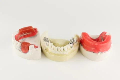 Wax rollers on the tooth model Stock Photos