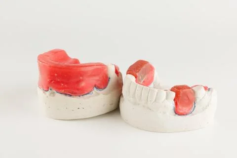Wax rollers on the tooth model Foto stock
