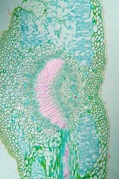 Weed leaf cross section under the microscope 100x Stock Photos