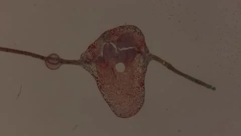 Weeping willow, leaf gall tissue Stock Footage 292283004