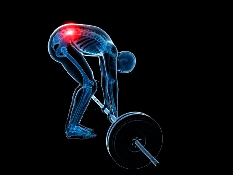Weight lifting, incorrect posture Stock Illustration