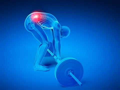 Weight lifting, incorrect posture Stock Illustration