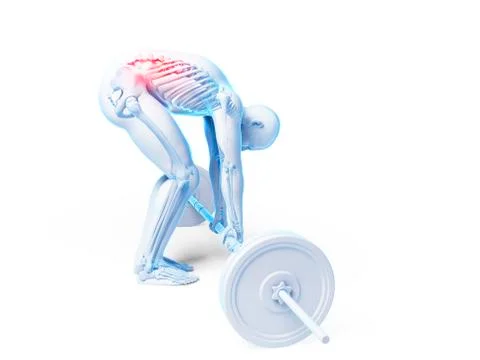 Weight lifting, incorrect posture Stock Illustration