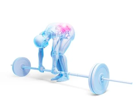 Weight lifting, incorrect posture Stock Illustration