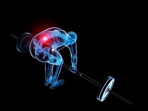 Weight lifting, incorrect posture Stock Illustration