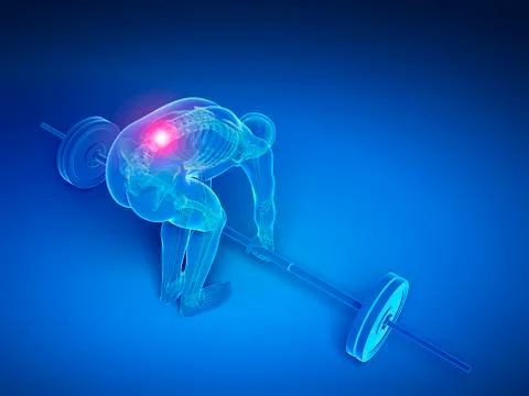Weight lifting, incorrect posture Stock Illustration