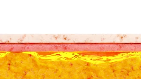 Weight loss Comparison. Before and after a thick and thin waist, Fat belly burn Stock Footage 271124496