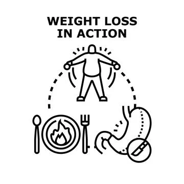 Weight loss concept showing exercise diet and bariatric surgery Stock Illustration