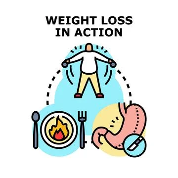 Weight loss concept showing exercise diet and bariatric surgery Stock Illustration