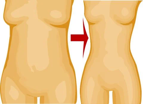 Weight loss Stock Illustration