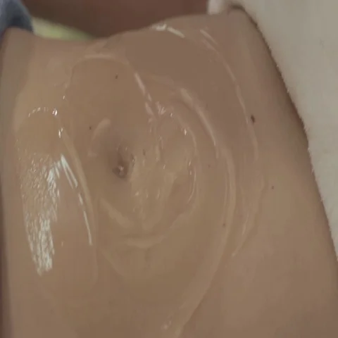 Weight loss therapy Stock Footage 69708987