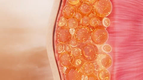 Weight loss  Weight reduction  Burning fat Video stock 314479464