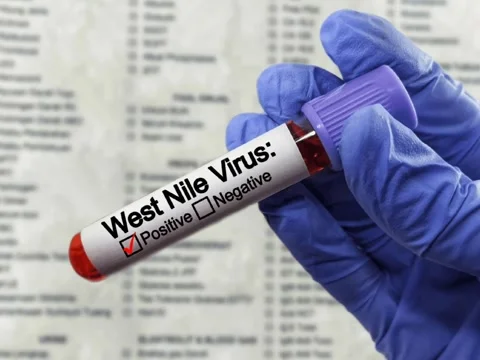 West Nile positive blood sample Stock Footage 292408852