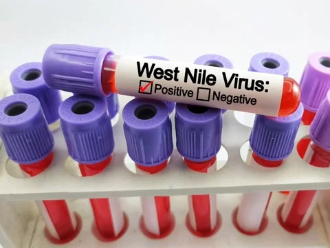 West Nile positive blood sample Stock Footage 292408863
