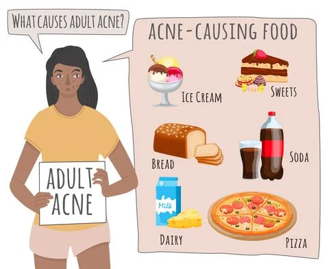 What causes acne. Acne-causing food landscape poster Stock Illustration