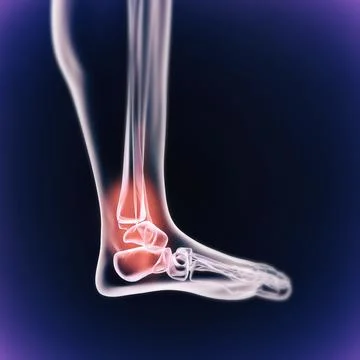 When inflammation strikes. A cgi view of an inflamed joint isolated on blue. Illustrazione stock