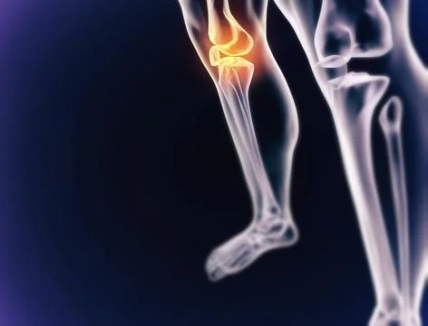 When inflammation strikes. A cgi view of an inflamed joint isolated on blue. Illustrazione stock