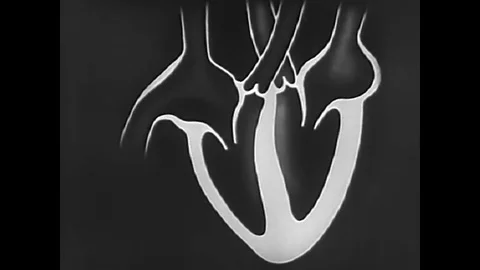 While resting, the heart beats in average 70 times per minute, but exercise Stock Footage 74704368