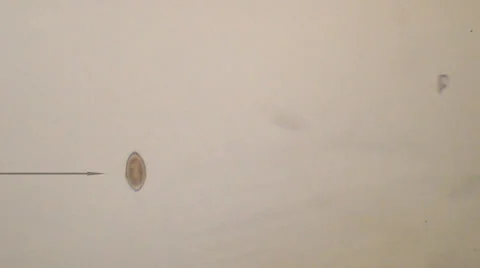 Whipworm Egg Veterinary Medicine Video stock 33869463