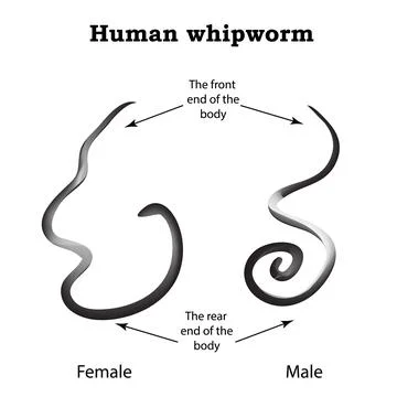 Whipworm.Infographics. Vector illustration on isolated background Stock Illustration