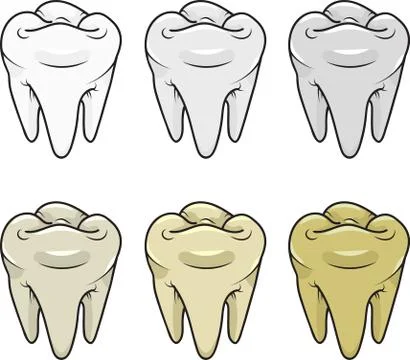 White and yellow teeth Stock Illustration