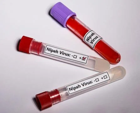 On a white background, three test tubes with the very widespread New Virus Stock Photos