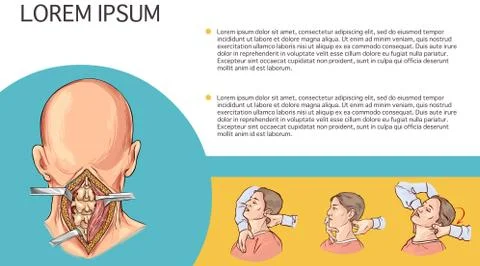 White background vector illustration of a Cervical Spine Illustrazione stock
