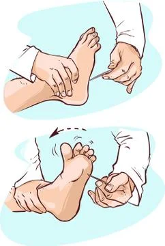 White background vector illustration of a neurological examination Illustration