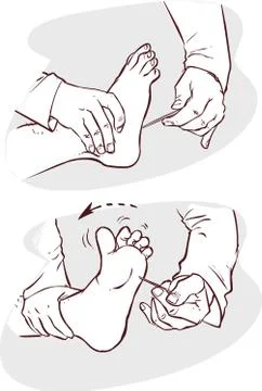 White background vector illustration of a neurological examination Stock Illustration