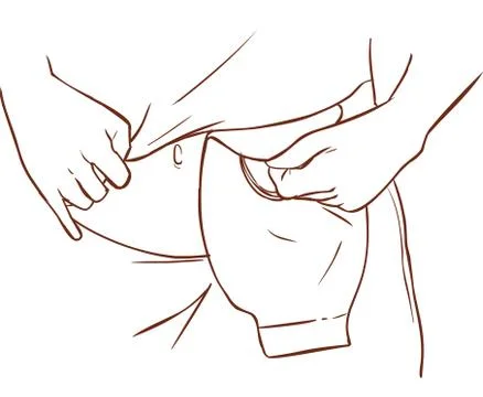 White background vector illustration of a ostomy bag Stock Illustration