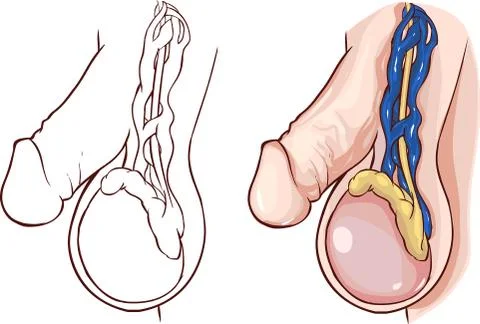 White background vector illustration of a  Varicocele Illustrazione stock