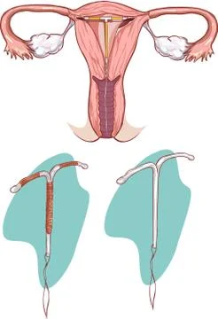 White backgroundvector illustration of a Installing illustration spiral Stock Illustration