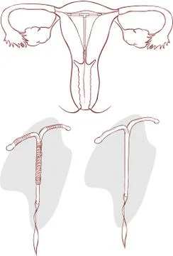 White backgroundvector illustration of a Installing illustration spiral Stock Illustration