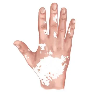 White backround digital illustration Human skin and hair structure Stock Illustration