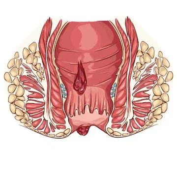 White backround Vector illustration of a hemorrhoid Stock Illustration