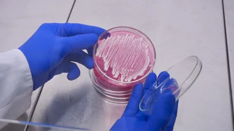 White bacterial colonies shine Stock Footage 194773605