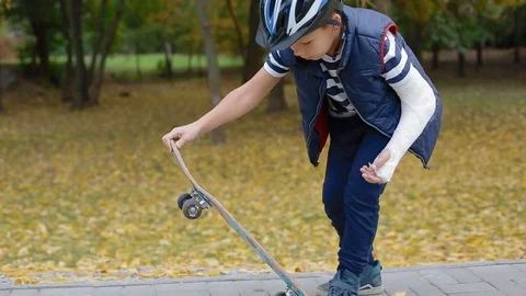 White boy with broken arm try to do a trick on skate Stock Footage 83995219