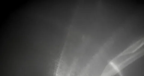 White Caustic Trails On Black Stock Footage 314231492