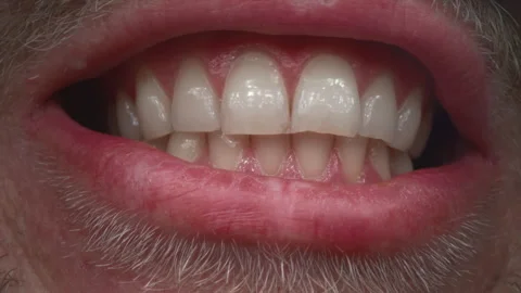 White clean teeth of a man. The guy shows his jaw, smiles beautifully. Oral care Stock Footage 252514632