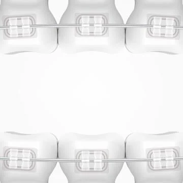 White Clear Teeth With Ceramic Braces Ilustração Stock