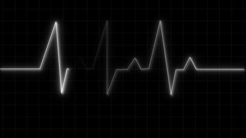 White electrocardiogram line on a dark grid background heart rate pulse ani.. Stock Footage 340998300