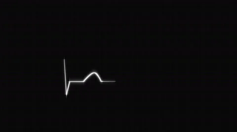 White HeartBeat Cardiogram on Grid Background. Stock Footage 58882611