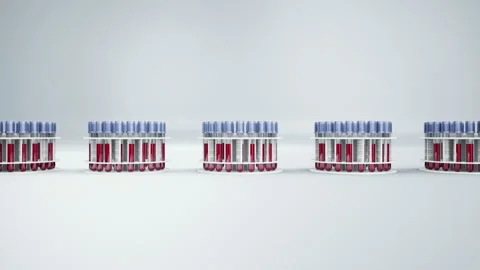 White holders with vacutainers filled with blood samples. 動画素材 106941834