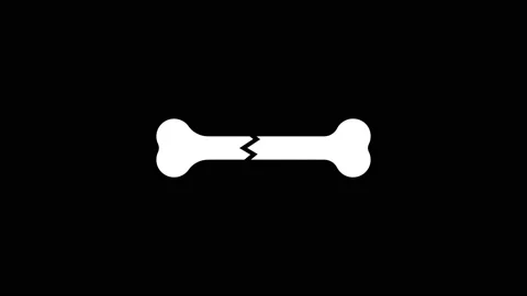 White picture of broken bone on a black background. Stock Footage 200785962