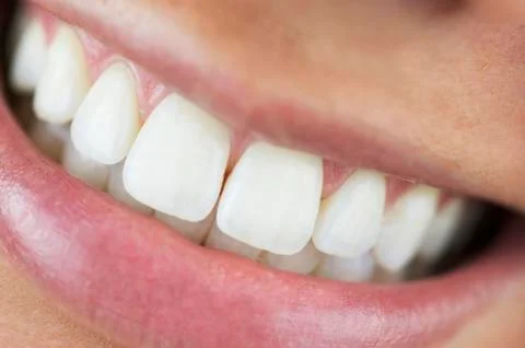 White Smile 스톡 사진