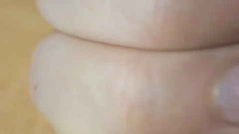 White spots on fingernails close up Stock Footage 86767141